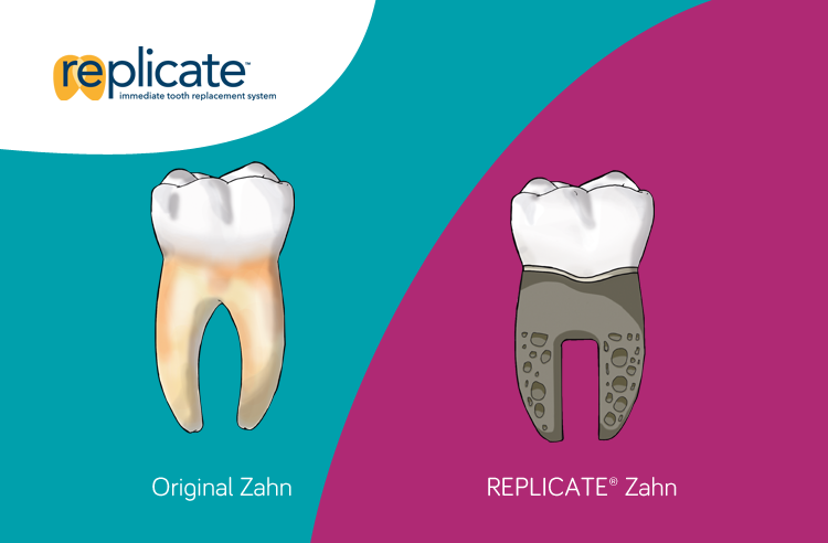 REPLICATE System - Original vs. Implant