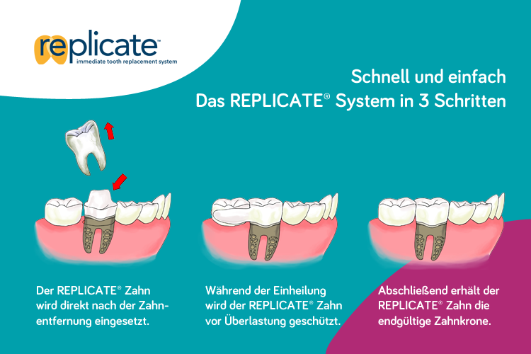 Das REPLICATE System in 3 Schritten